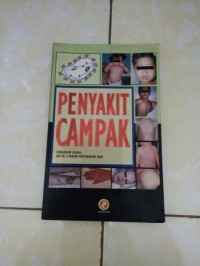 Image of Penyakit Campak