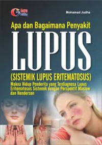 Image of Apa dan Bagiamana Penyakit Lupus